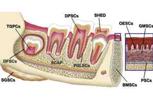 Dental Stem Cell Therapy
