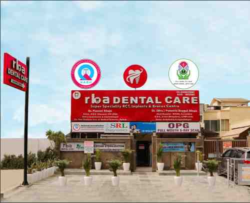 Best Root Canal Treatment Faridabad
